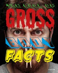 The book of gross body facts / [by Charles Hope].